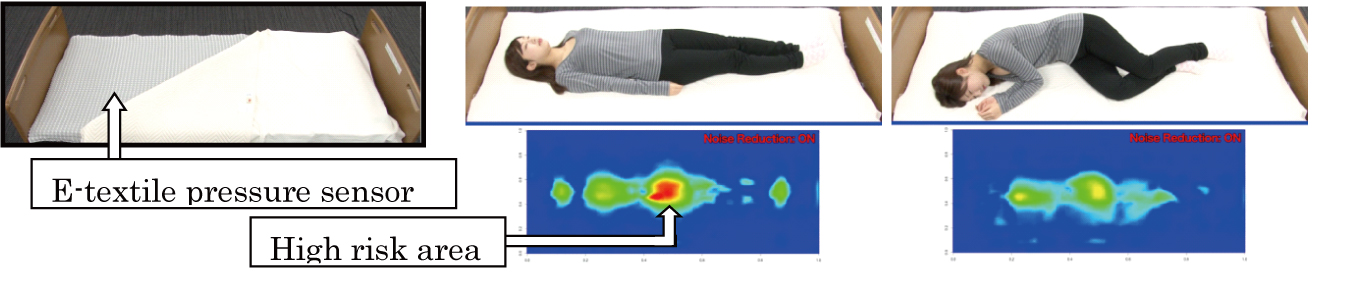 Bed-size e-textile pressure sensor and examples of sensing result.