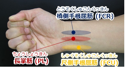 図8 三本の刺激腱